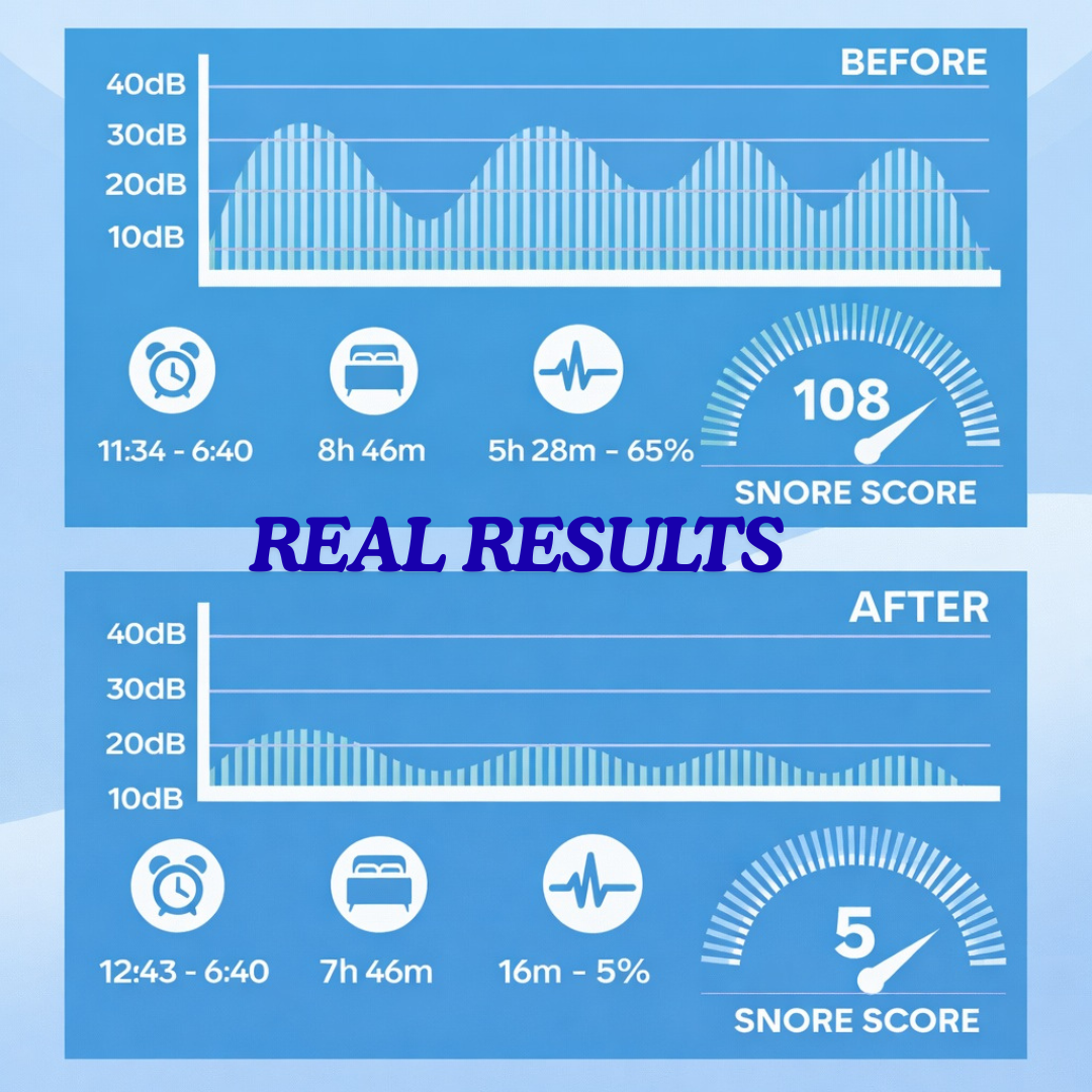 Anti-snoring mouthpiece